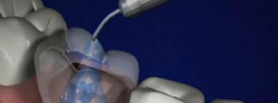endodontics-header-1800×400