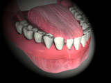 pre-denture-problems