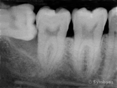 x-rays-toothiq-384