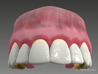 dental-symptom-gums-toothiq-384