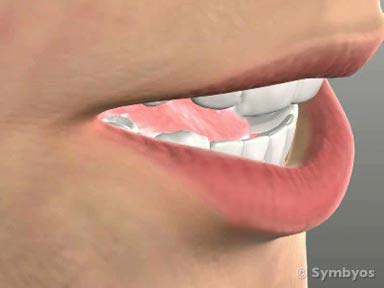 dental-symptom-lips-and-tongue-toothiq-384