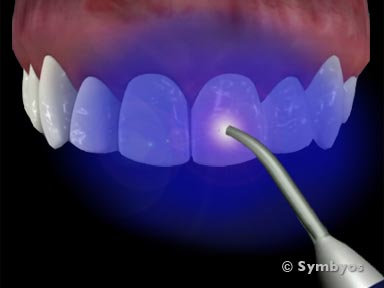 dental-symptom-mouth-general-toothiq-384