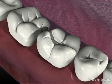 dental-symptom-tooth-misc-toothiq-384