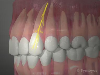 dental-symptom-toothache-pain-sensitivity-toothiq-384