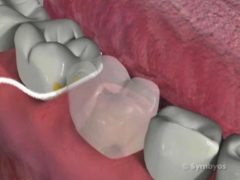 How to Floss Your Teeth thumbnail